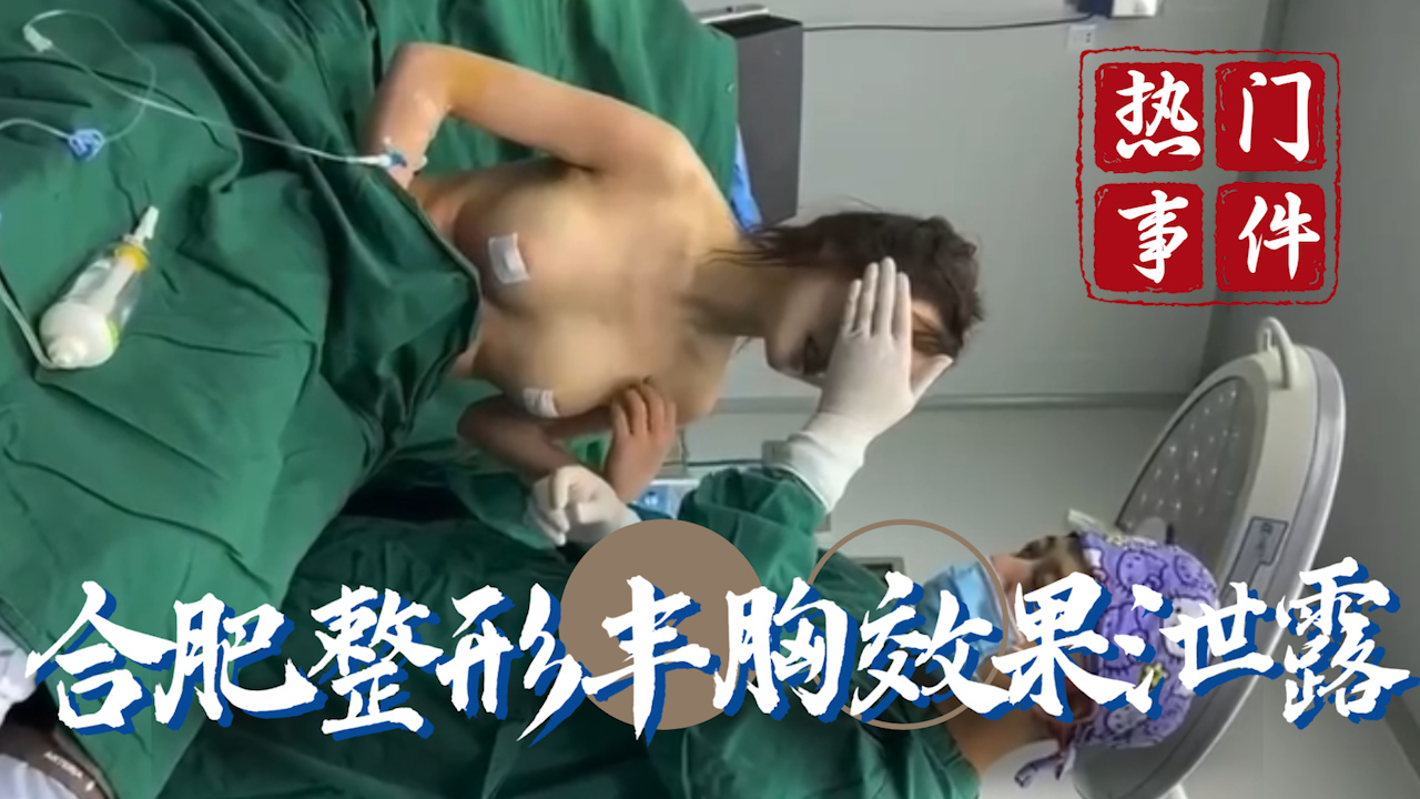 【吃瓜事件】合肥整形丰胸效果流出_
