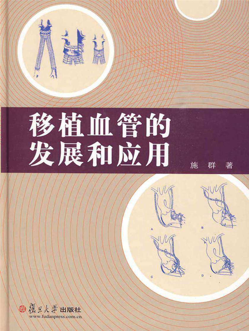 移植血管的发展和应用