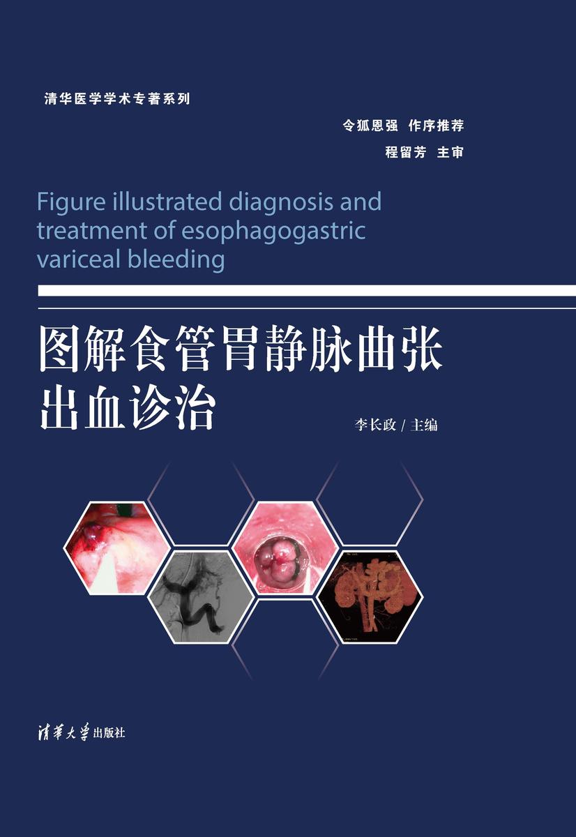 图解食管胃静脉曲张出血诊治