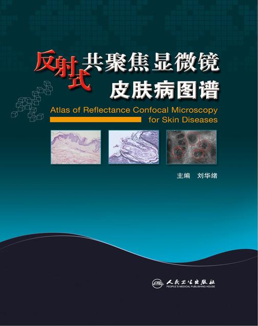 反射式共聚焦显微镜皮肤病图谱
