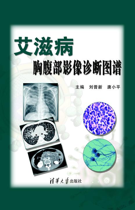 艾滋病胸腹部影像诊断图谱