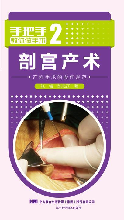 剖宫产术:产科手术的操作规范