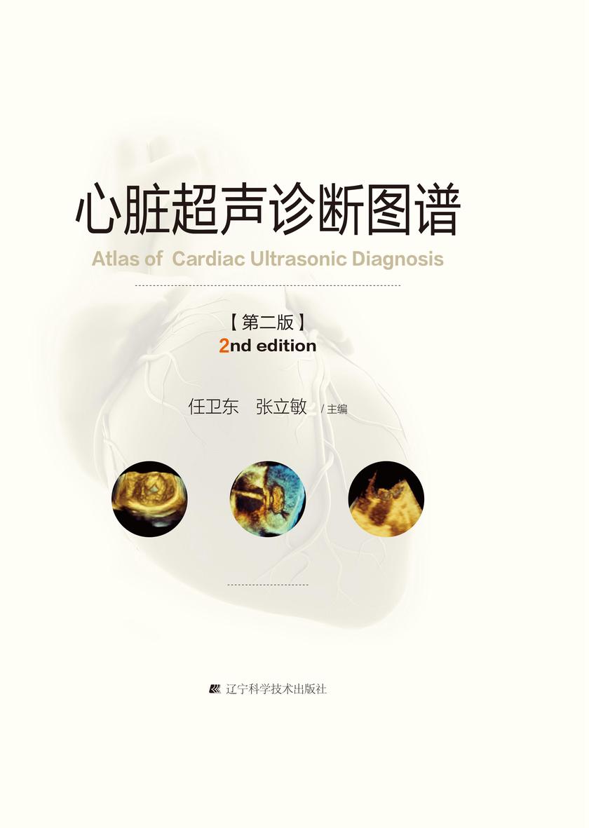 心脏超声诊断图谱