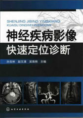 神经疾病影像快速定位诊断(试读本)