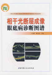 相干光断层成像眼底病诊断图谱(试读本)