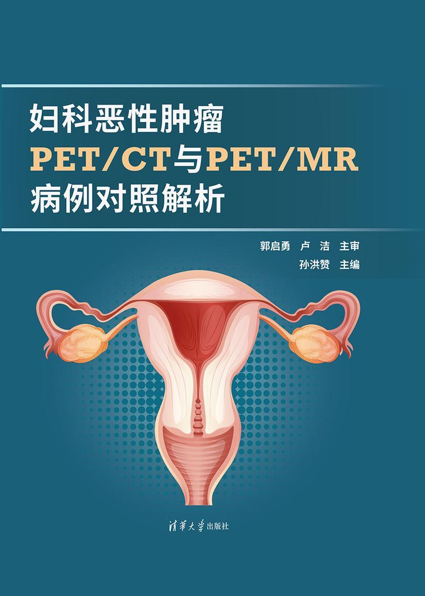 妇科恶性肿瘤PET CT与PET MR病例对照解析