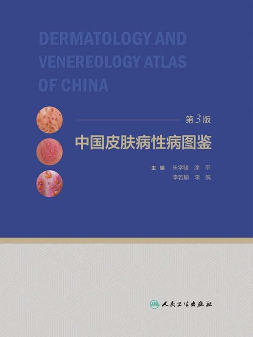 中国皮肤病性病图鉴(第3版)