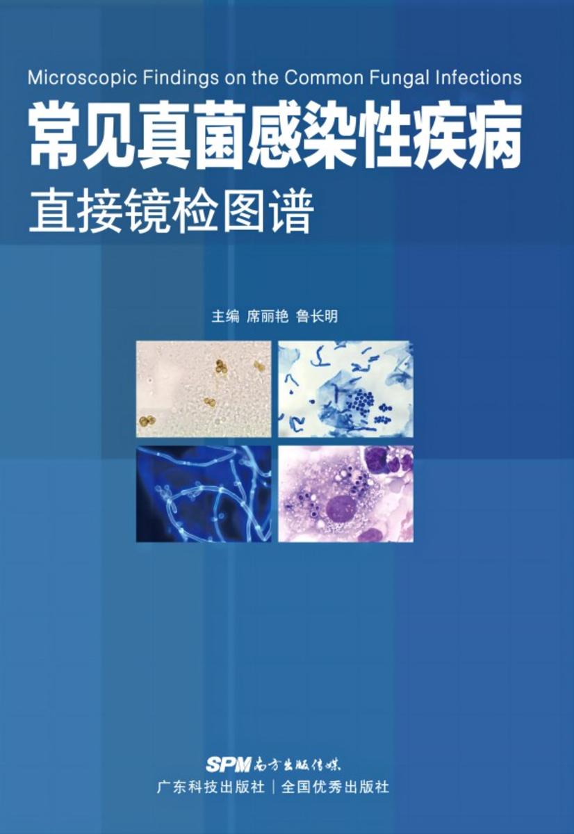 常见真菌感染性疾病直接镜检图谱