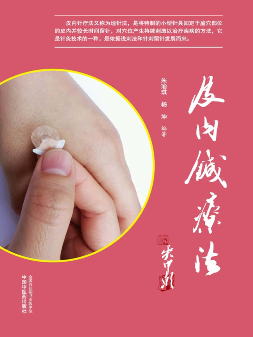 皮内针疗法