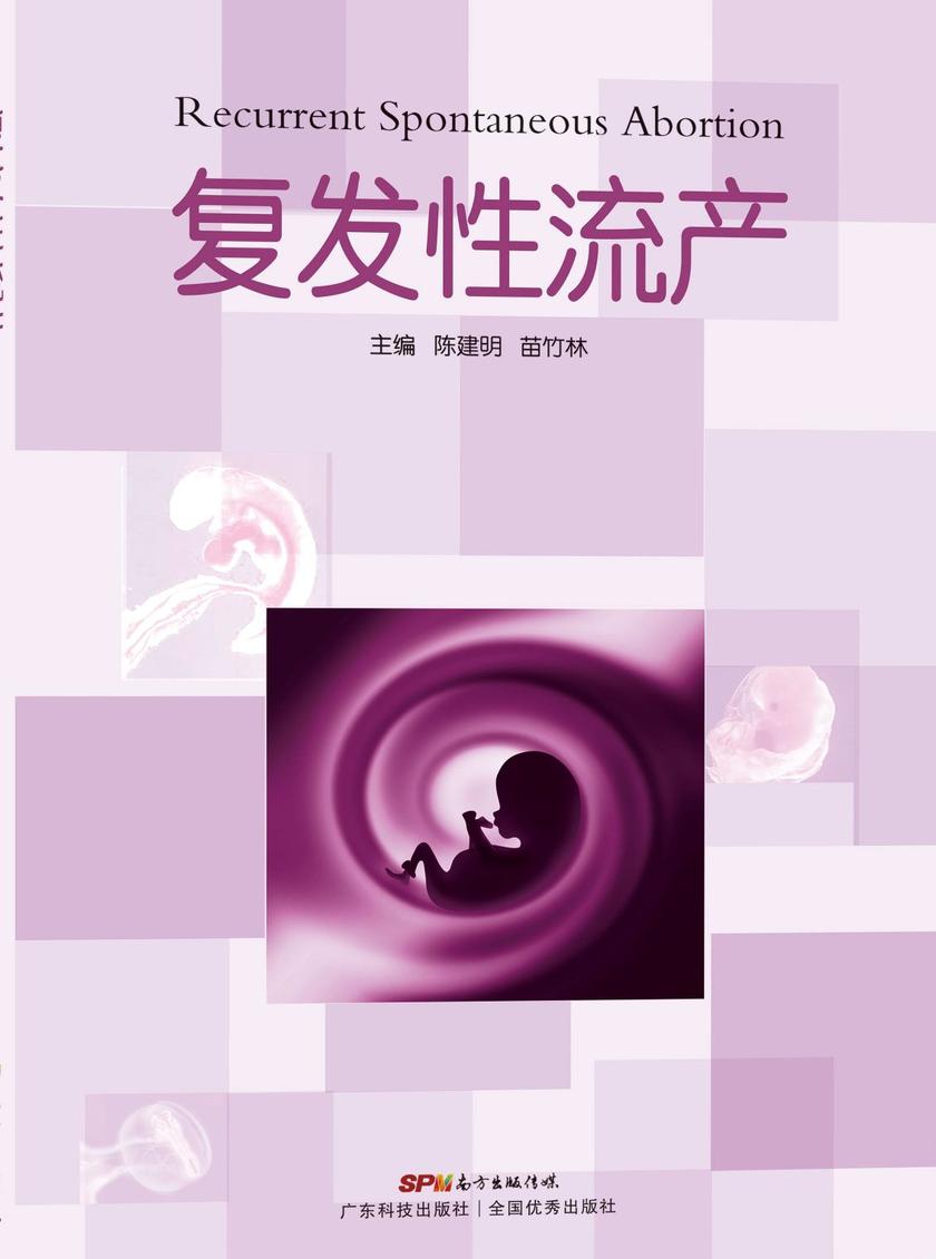 复发性流产