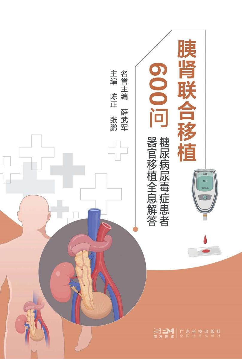 胰肾联合移植600问:糖尿病尿毒症患者器官移植全息解答