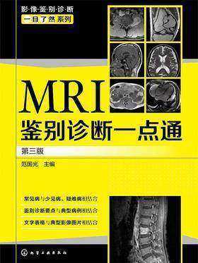 MRI鉴别诊断一点通