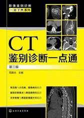 CT鉴别诊断一点通 第三版