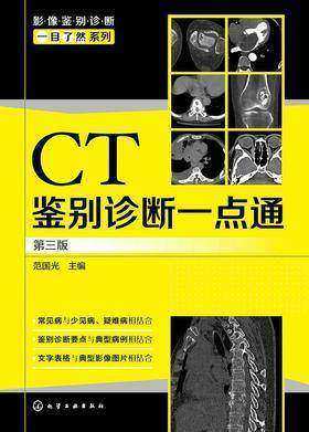 CT鉴别诊断一点通 第三版