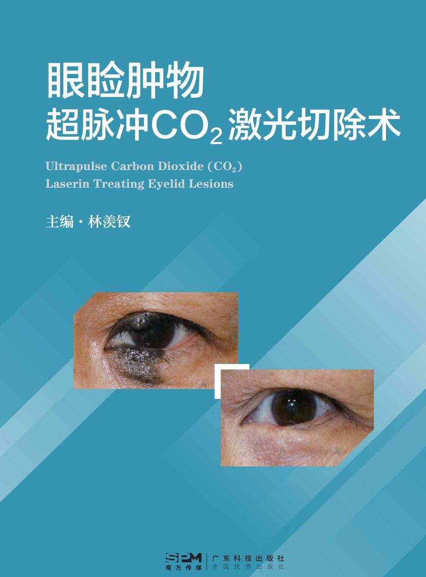 眼睑肿物超脉冲CO?激光切除术