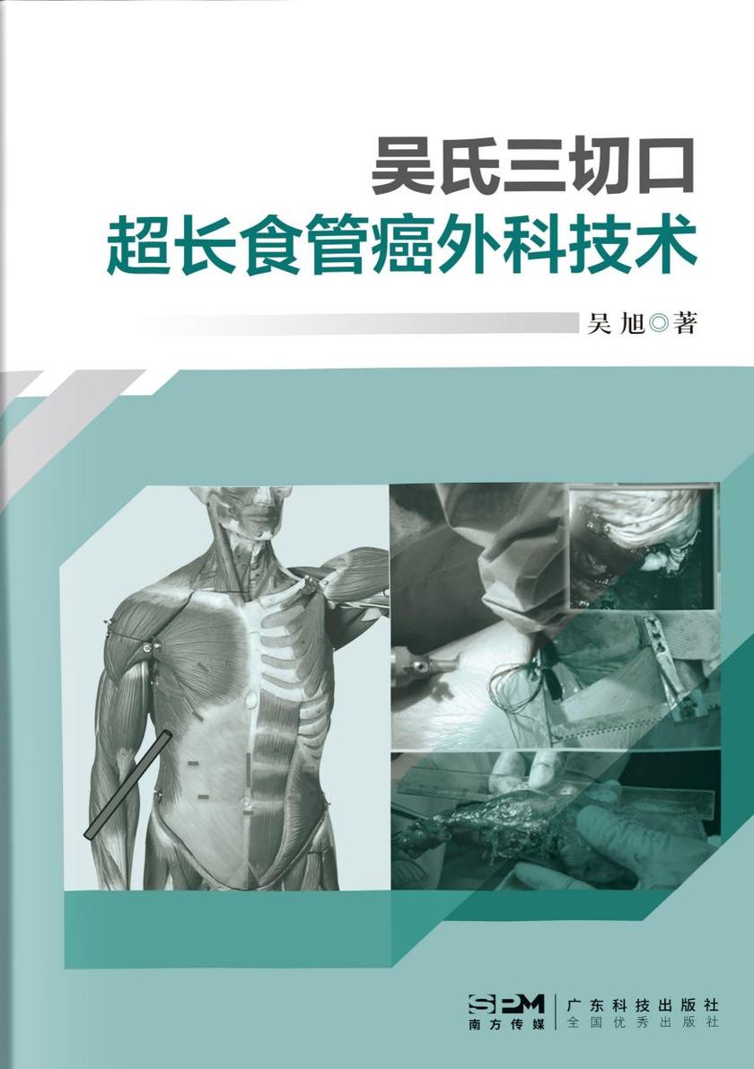 吴氏三切口:超长食管癌外科技术