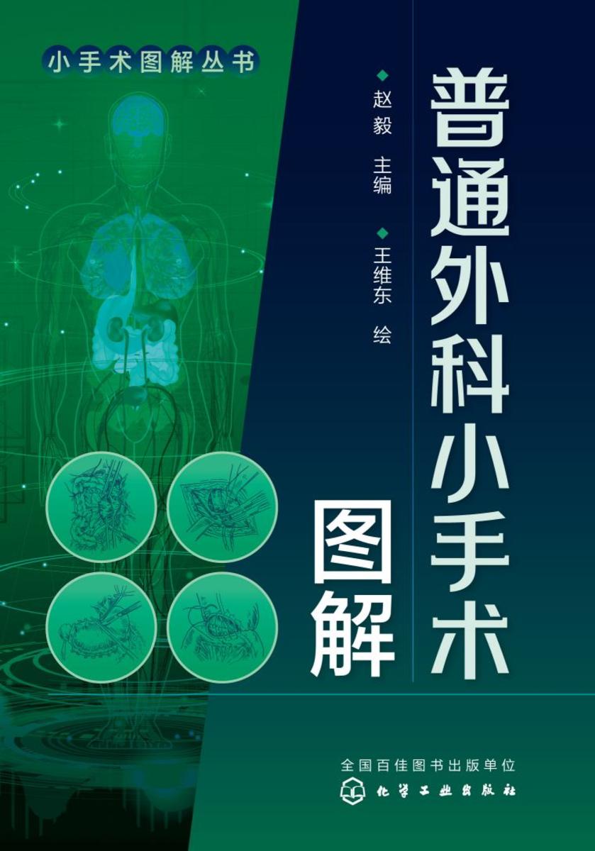 小手术图解丛书--普通外科小手术图解