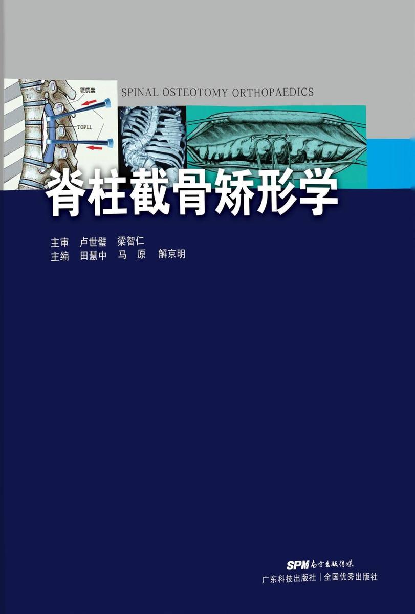 脊柱截骨矫形学