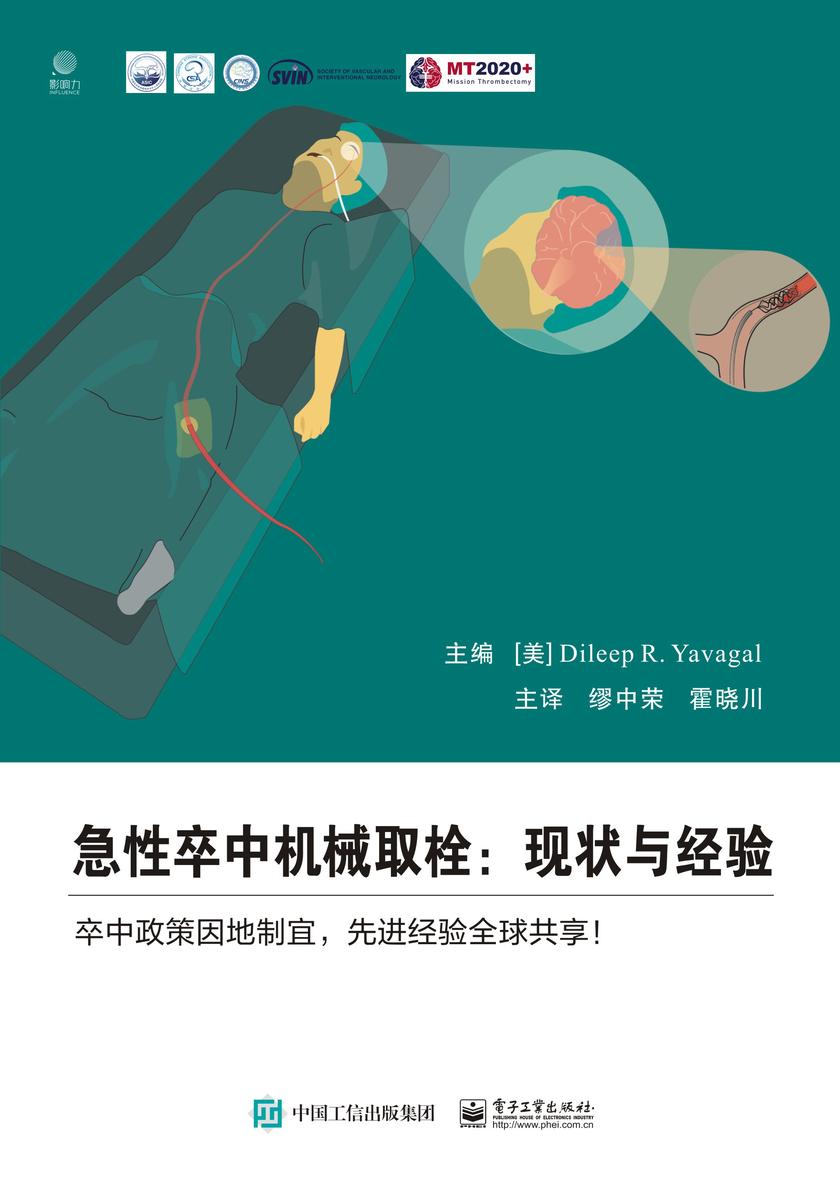 急性卒中机械取栓:现状与经验