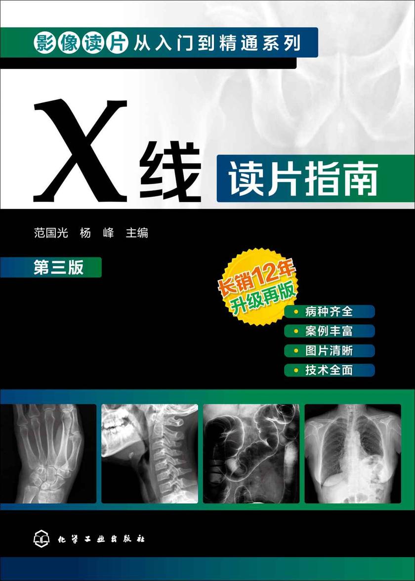 影像读片从入门到精通系列--X线读片指南(第三版)