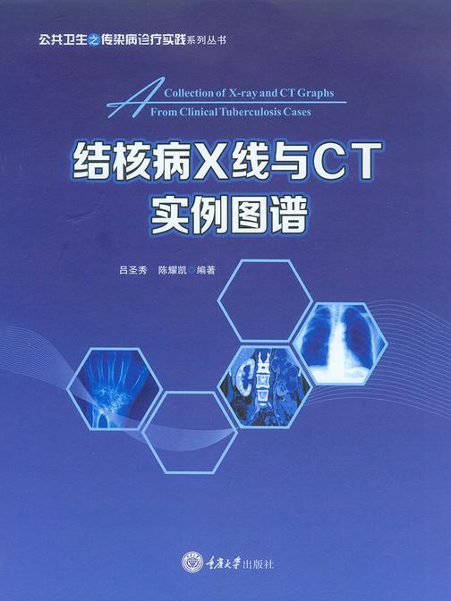结核病X线与CT实例图谱