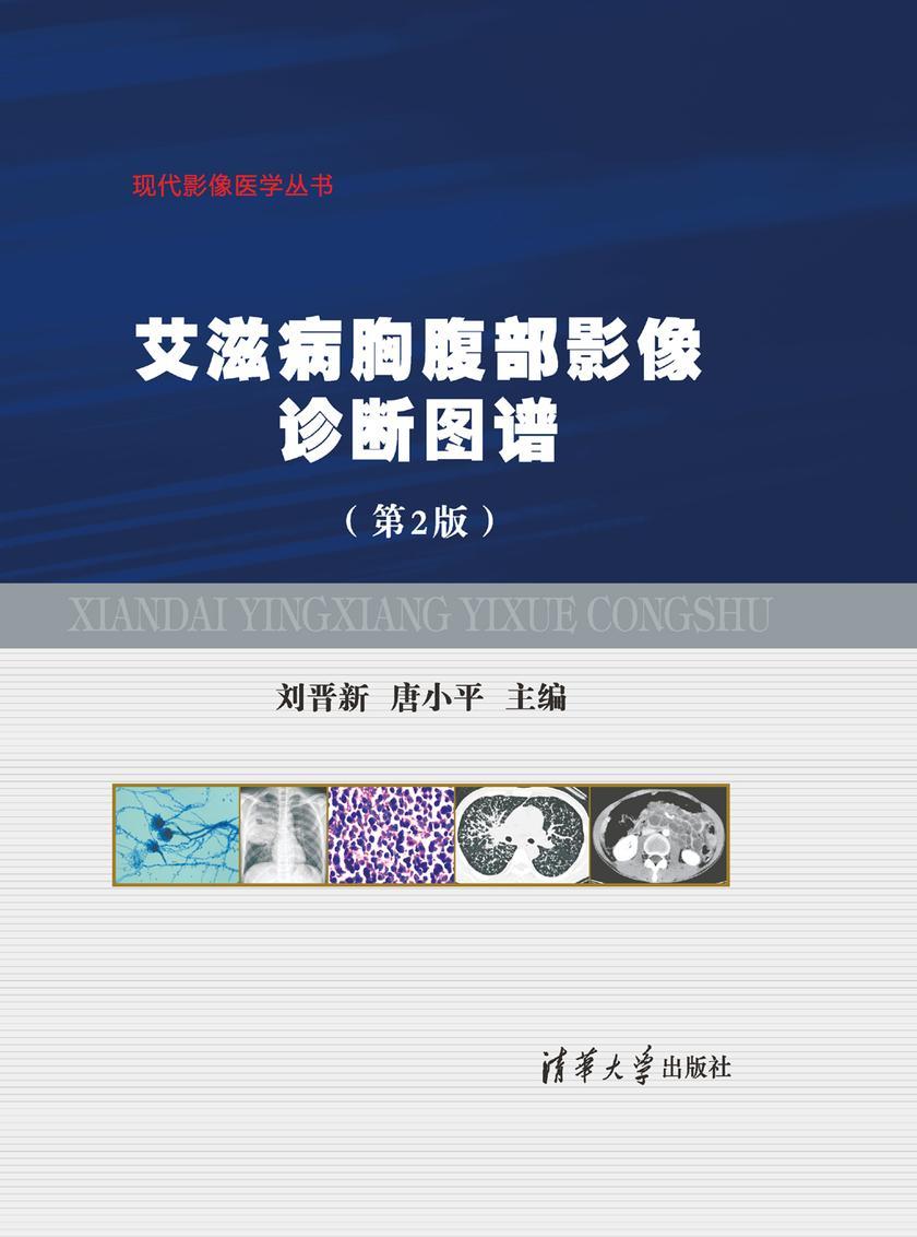 艾滋病胸腹部影像诊断图谱(第2版)