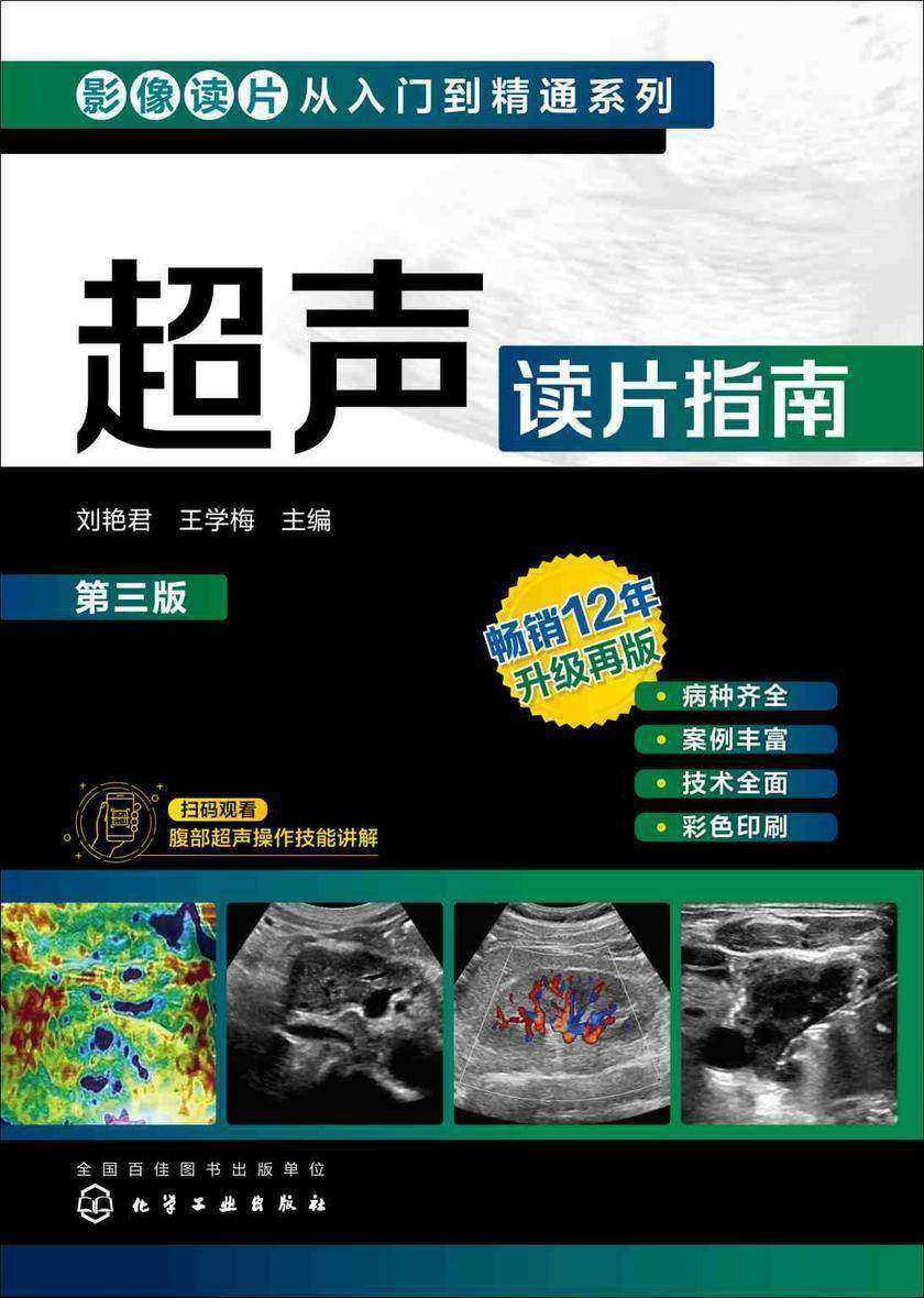 影像读片从入门到精通系列--超声读片指南(第三版)