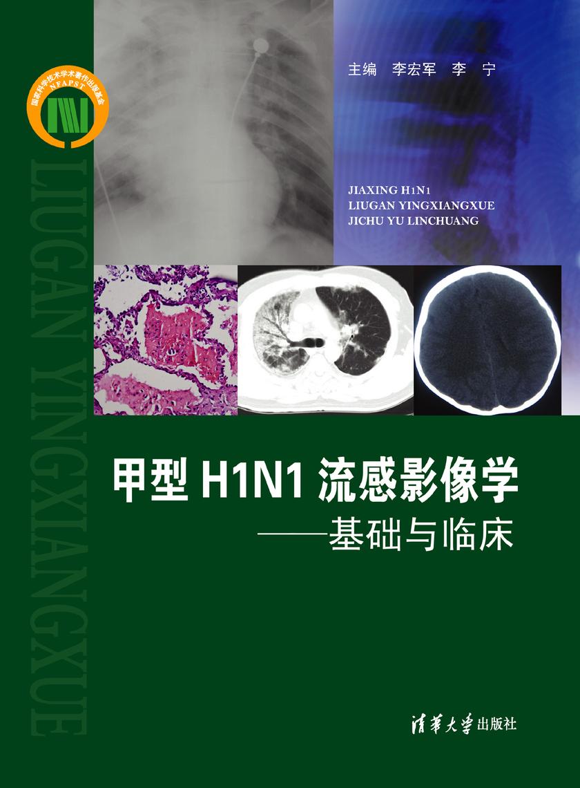 甲型H1N1流感影像学:基础与临床