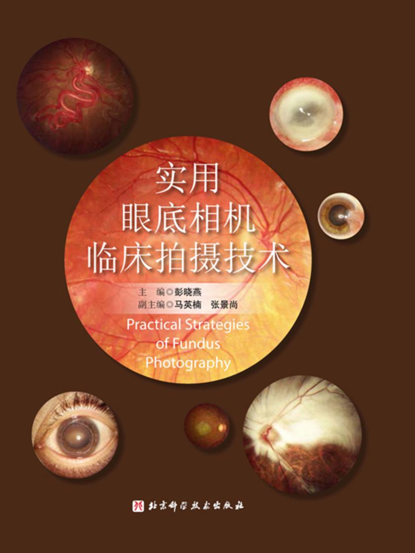 实用眼底相机临床拍摄技术