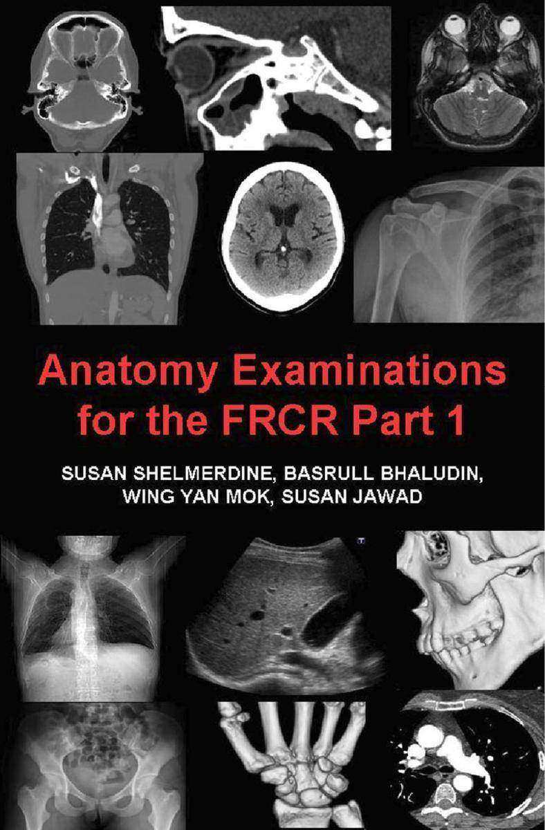 Anatomy Examinations for the FRCR Part 1