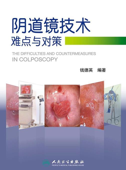 阴道镜技术难点与对策