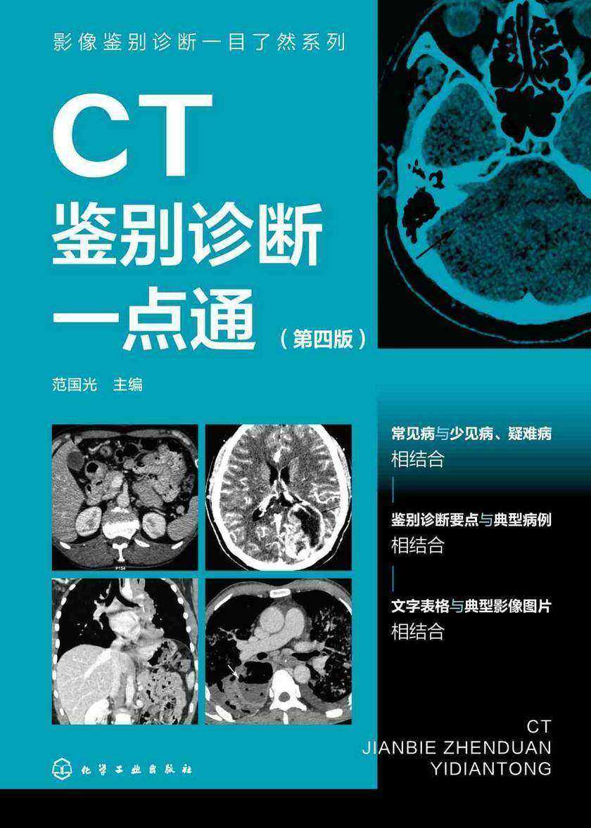 影像鉴别诊断一目了然系列--CT鉴别诊断一点通(第四版)