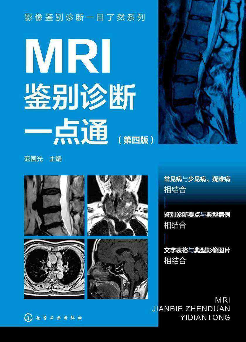 影像鉴别诊断一目了然系列--MRI鉴别诊断一点通(第四版)