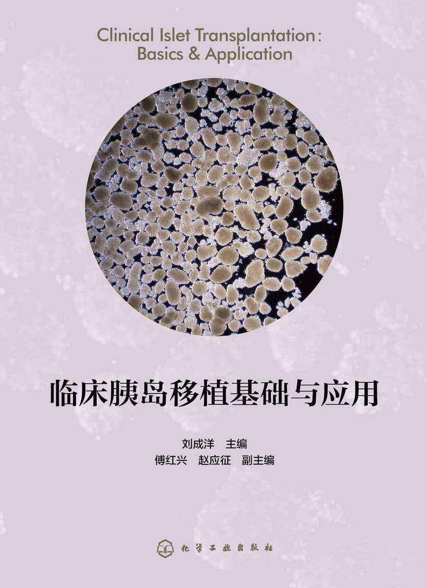 临床胰岛移植基础与应用