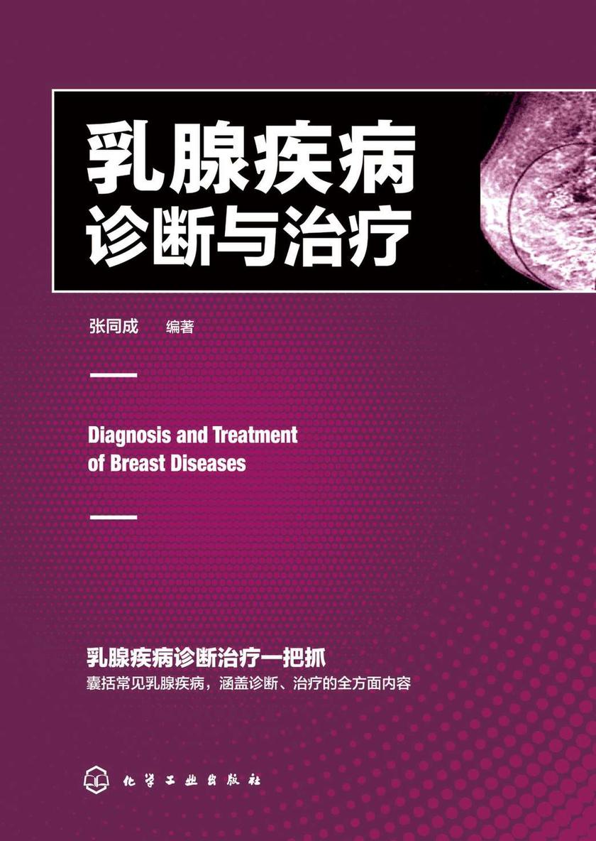 乳腺疾病诊断与治疗