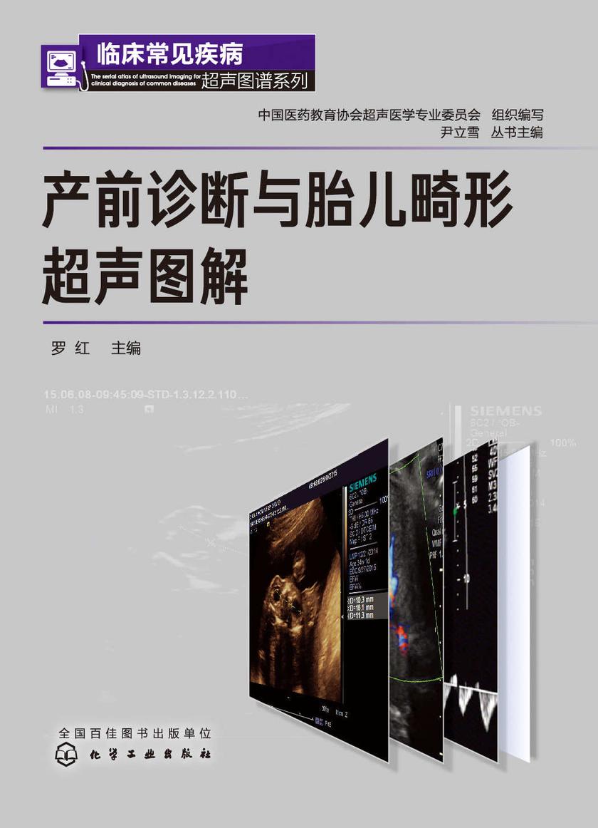 临床常见疾病超声图谱系列--产前诊断与胎儿畸形超声图解