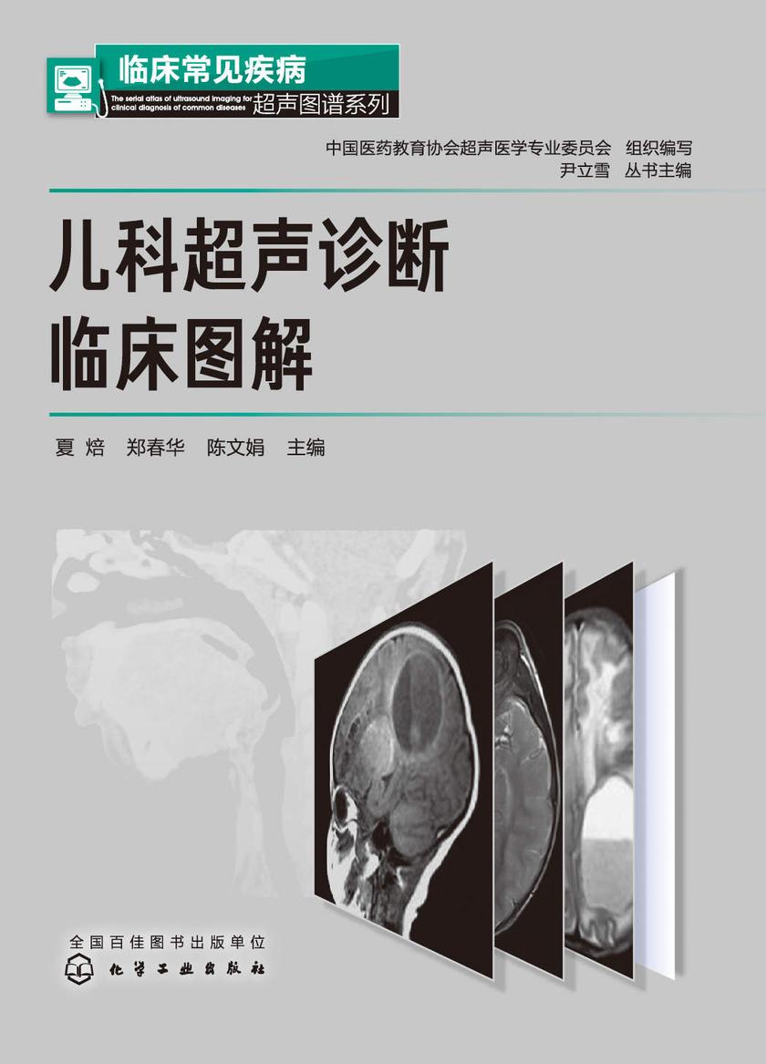临床常见疾病超声图谱系列--儿科超声诊断临床图解