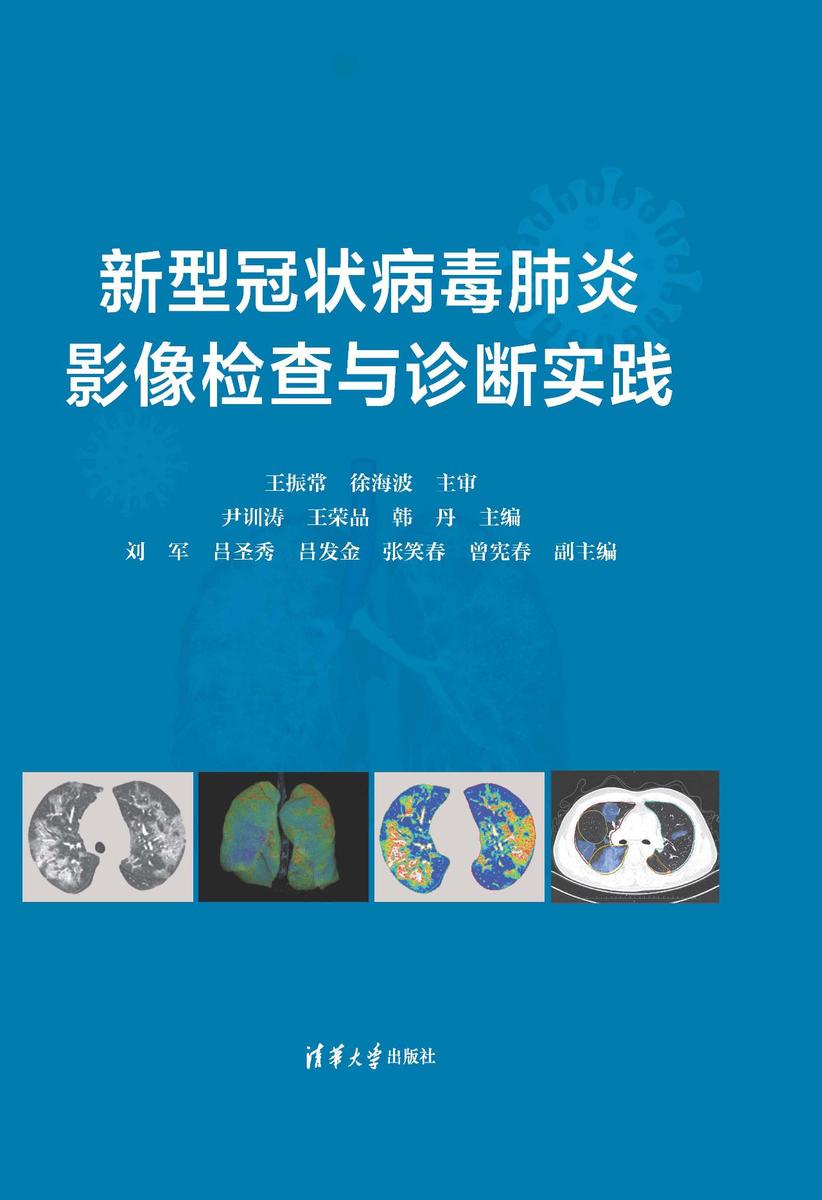 新型冠状病毒肺炎影像检查与诊断实践
