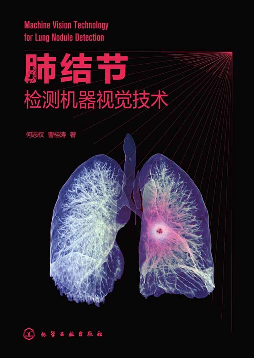 肺结节检测机器视觉技术