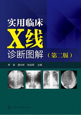 实用临床X线诊断图解(第二版)