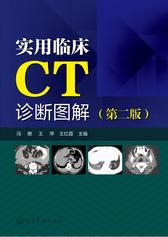 实用临床CT诊断图解(第二版)