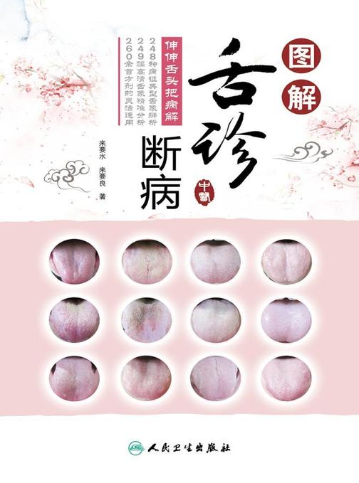 图解舌诊断病——伸伸舌头把病解