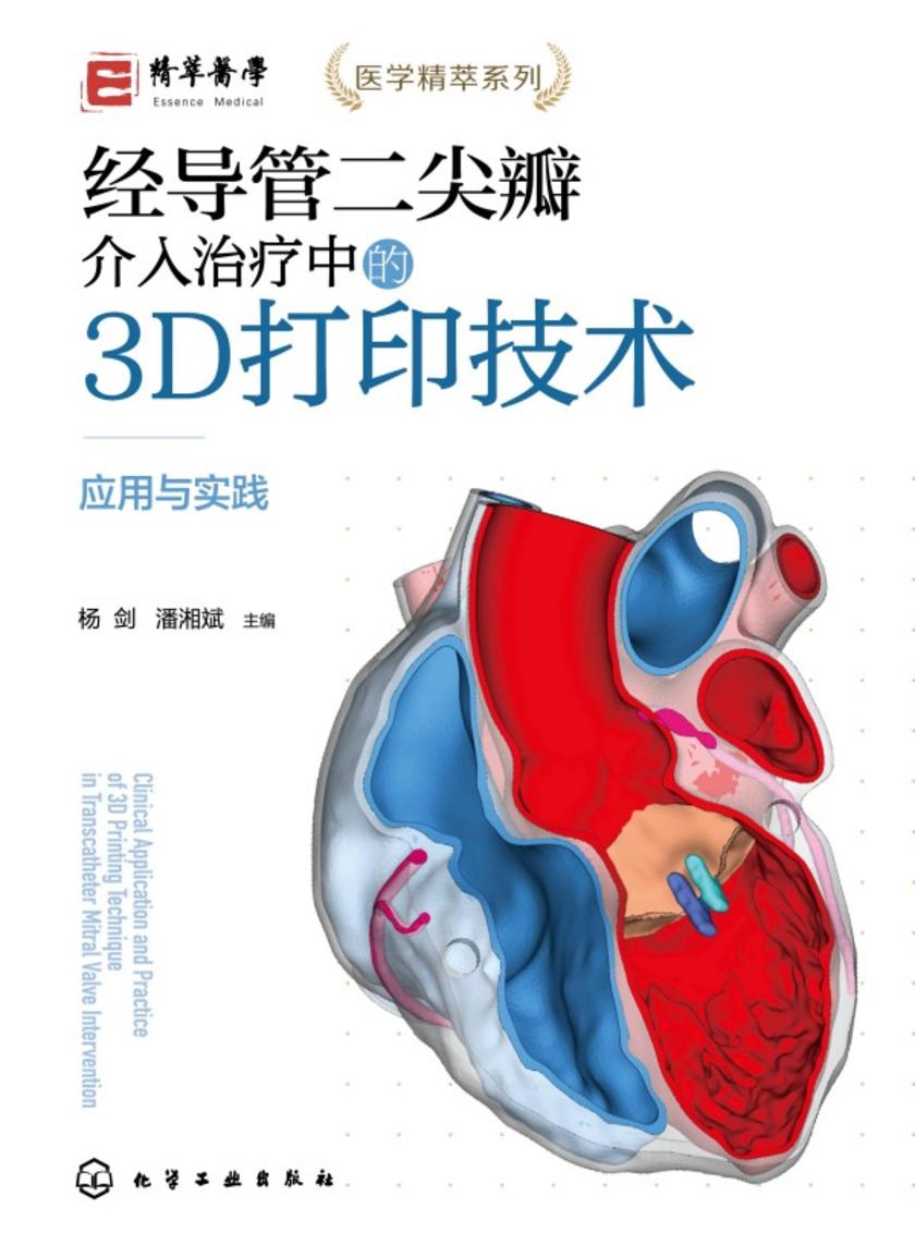 经导管二尖瓣介入治疗中的3D打印技术——应用与实践