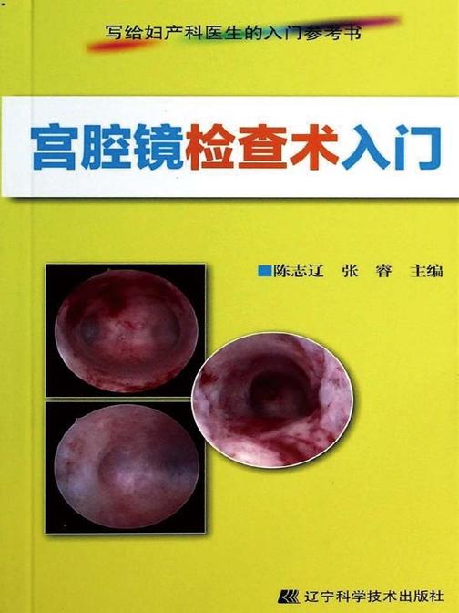 宫腔镜检查术入门