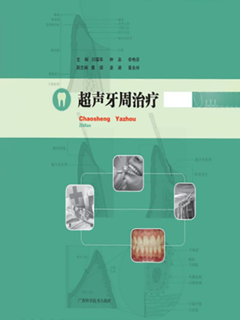 超声牙周治疗