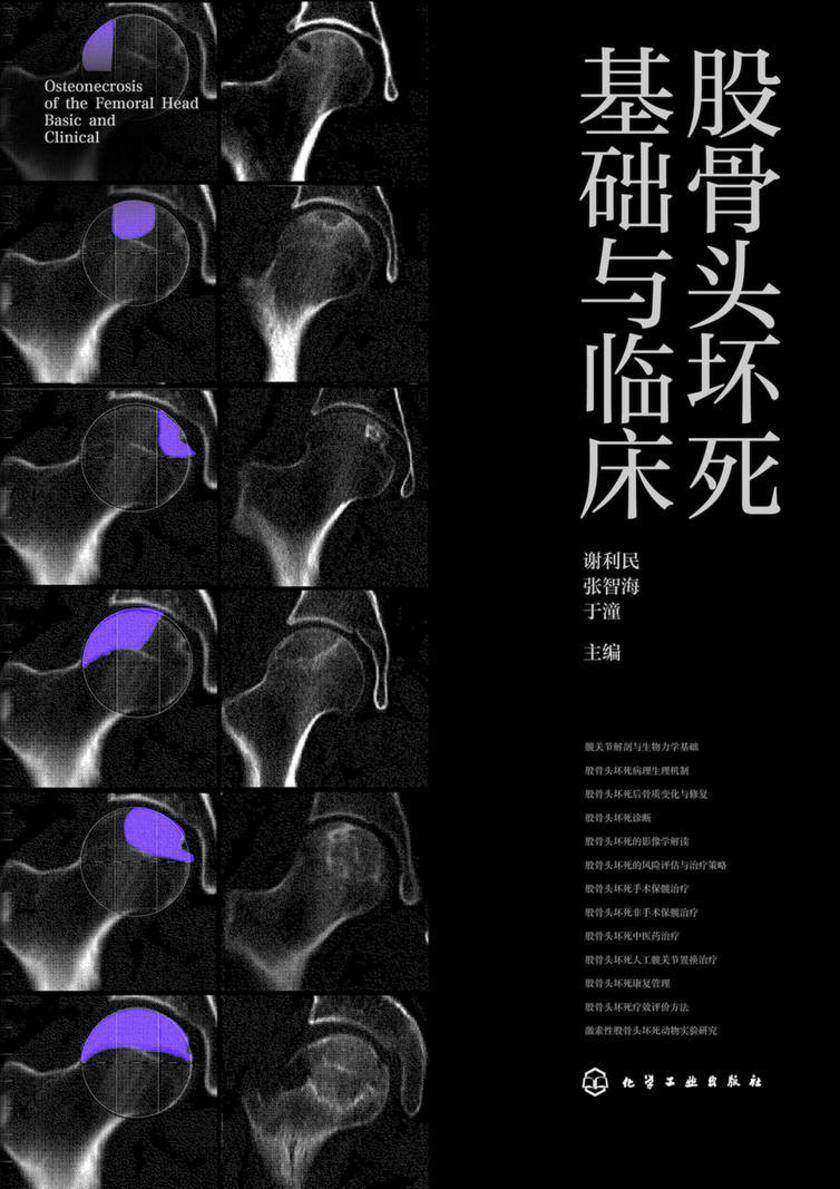 股骨头坏死基础与临床