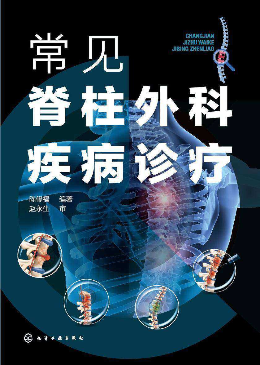 常见脊柱外科疾病诊疗