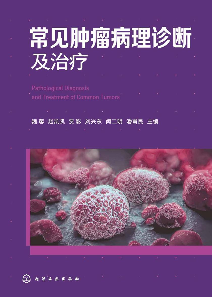 常见肿瘤病理诊断及治疗