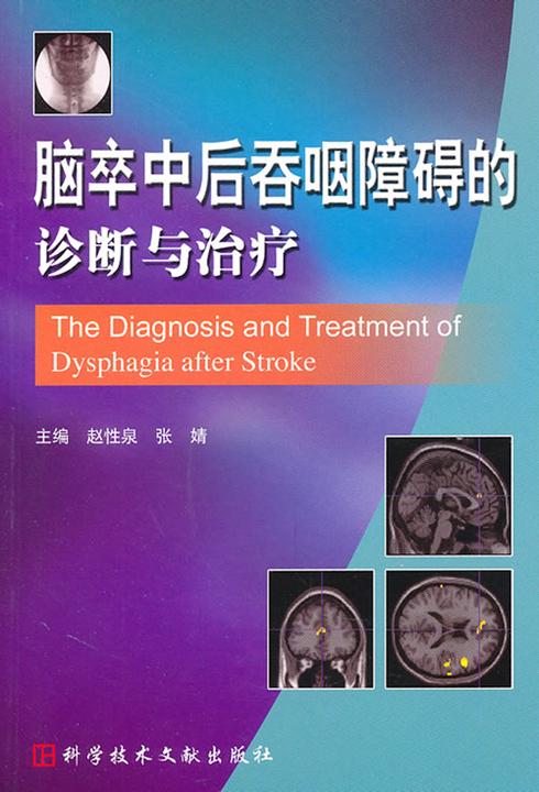 脑卒中后吞咽障碍的诊断与治疗