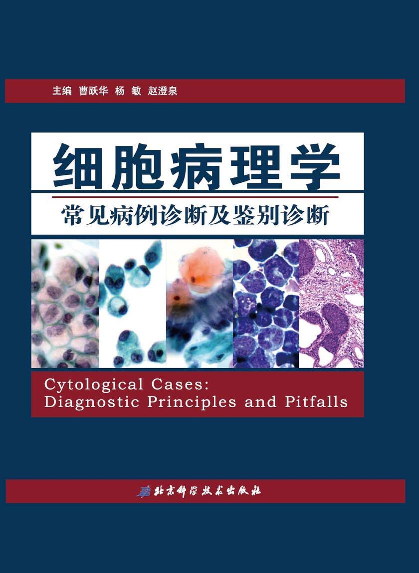 细胞病理学常见病例诊断及鉴别诊断